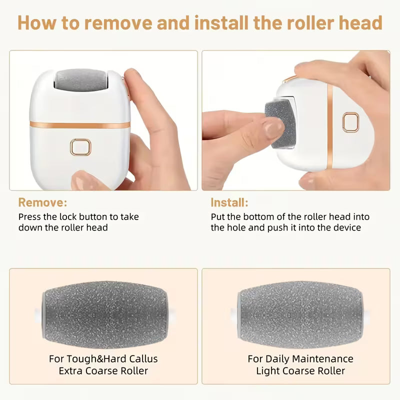 Electric Callus Remover
