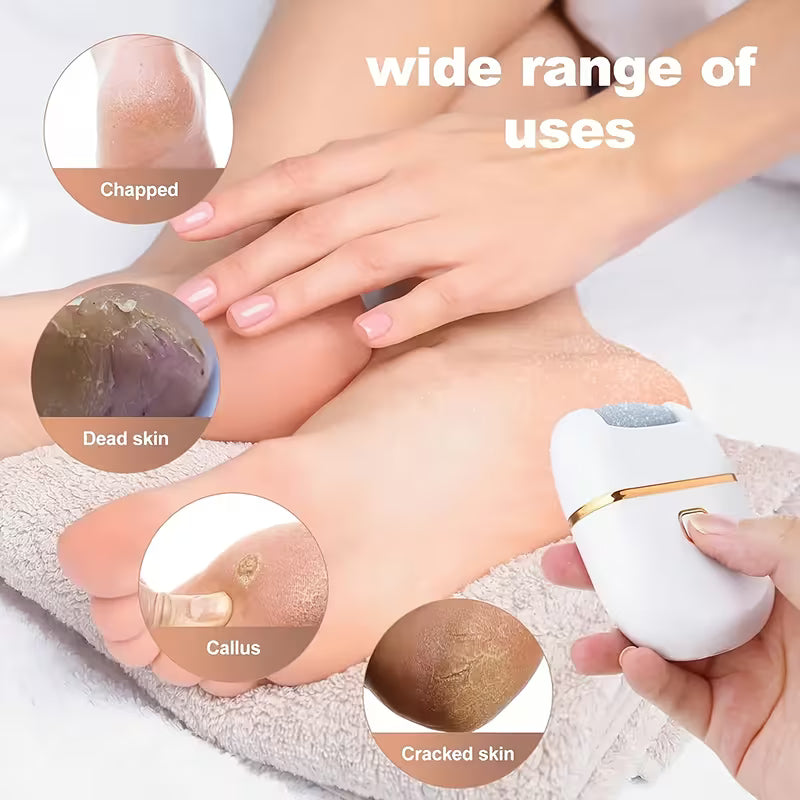 Electric Callus Remover