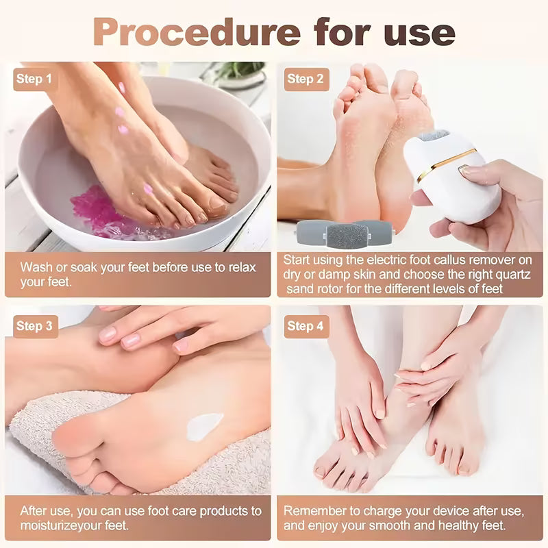 Electric Callus Remover