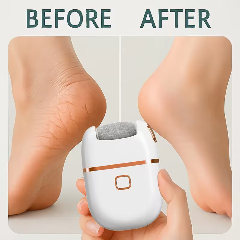 Electric Callus Remover